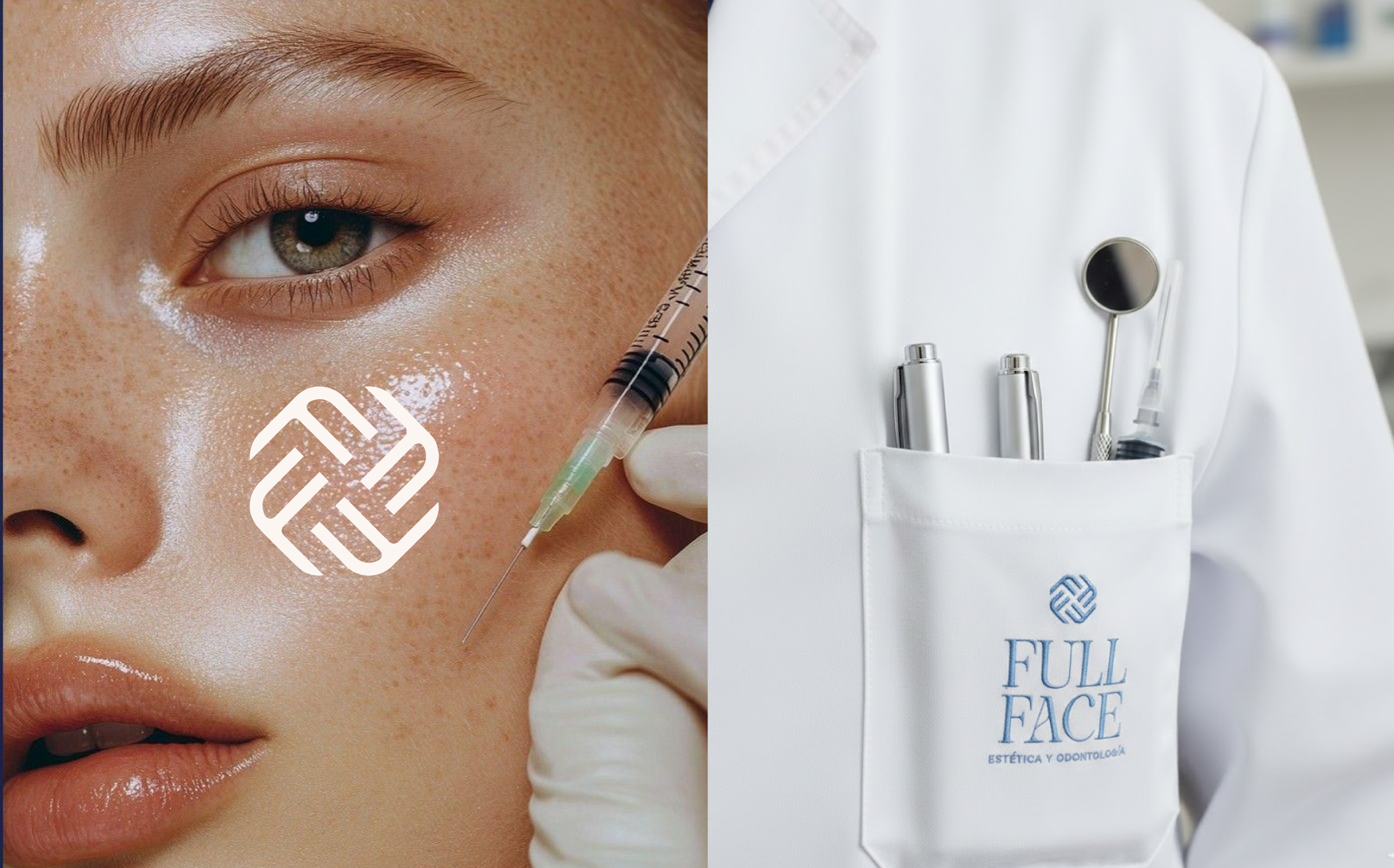 Armonización Facial